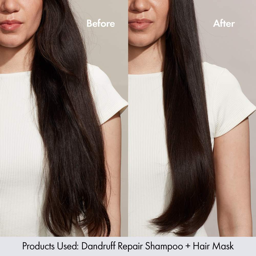 Bondi Boost Dandruff Treatment Mask 250ml