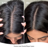 BONDI BOOST Dandruff Repair Leave-In Scalp Serum-125ml