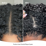 BONDI BOOST Dandruff Repair Leave-In Scalp Serum-125ml